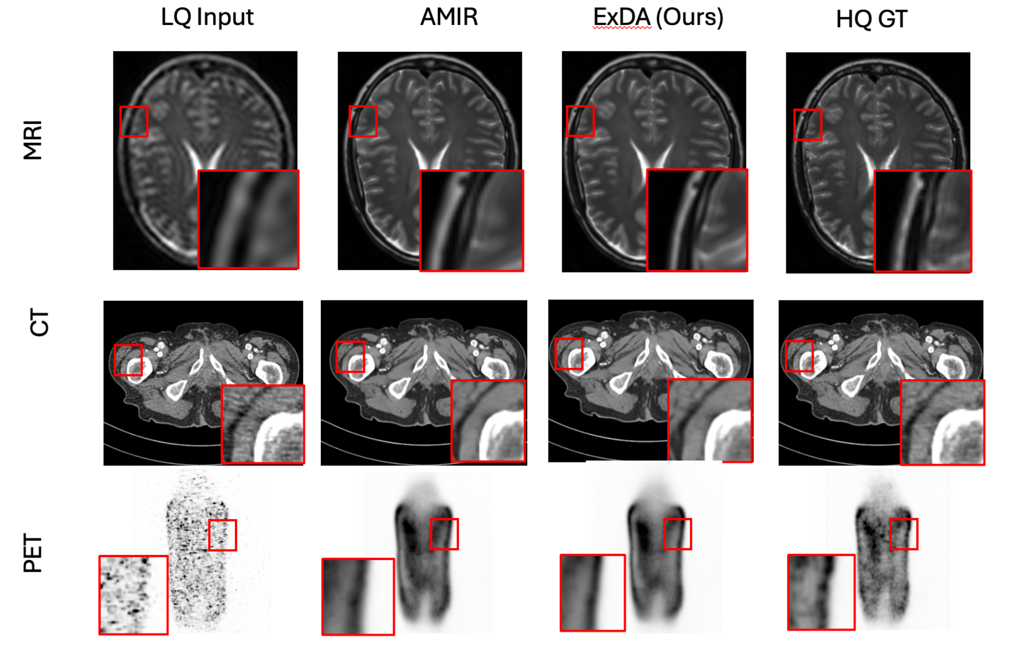 Medical imaging results on MRI, CT, and PET.